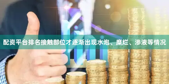 配资平台排名接触部位才逐渐出现水泡、糜烂、渗液等情况